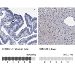 CROCC Antibody, Novus Biologicals 25 &mu;L; Unlabeled:Antibodies, Polyclonal